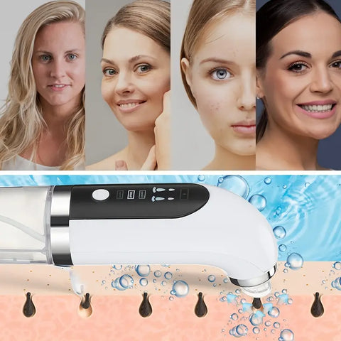 Electric Vacuum Blackhead Acne Pore Cleaner Water Cycle Skin Deep Cleaning USB Rechargeable Small Bubbles Beauty Care Tools