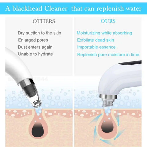 Electric Vacuum Blackhead Acne Pore Cleaner Water Cycle Skin Deep Cleaning USB Rechargeable Small Bubbles Beauty Care Tools